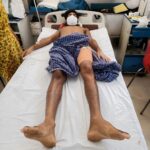 Under CM’s Health Scheme, youth underwent successful hip replacement surgery at MLN Medical College